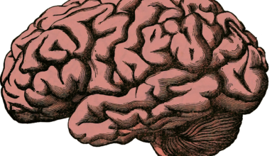 brain1