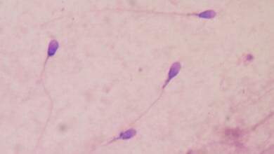 sperm 2